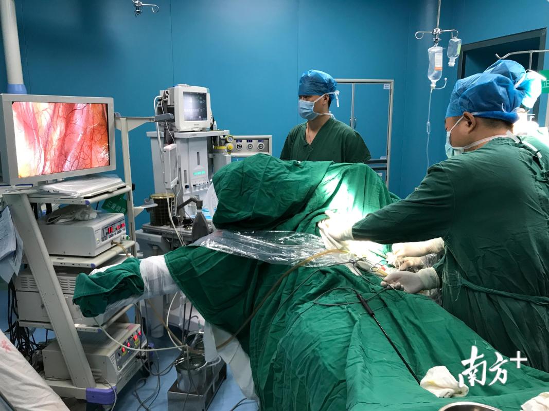 廖小卒（左一）在饶平县人民医院开展保留自主呼吸的胸科手术麻醉。