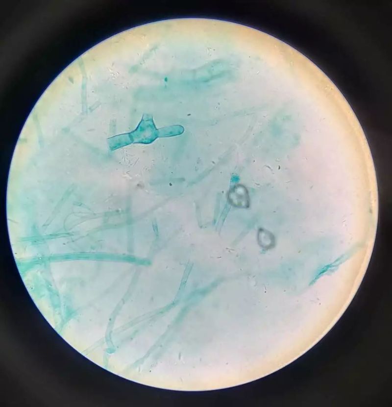 一起看四倍光镜下的地钱精子器切片以及四倍和四十倍光镜下的颈卵器