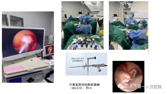 宫内镜怎么进入子宫【高水平医院建设】一探究“镜”新法宝：阴道内镜技术_https://www.jmylbn.com_新闻资讯_第7张