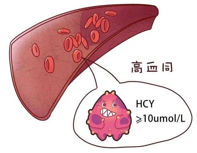 同型半氨酸怎么化验【科普】同型半胱氨酸，一个您还不知道的健康猎手！_https://www.jmylbn.com_新闻资讯_第3张