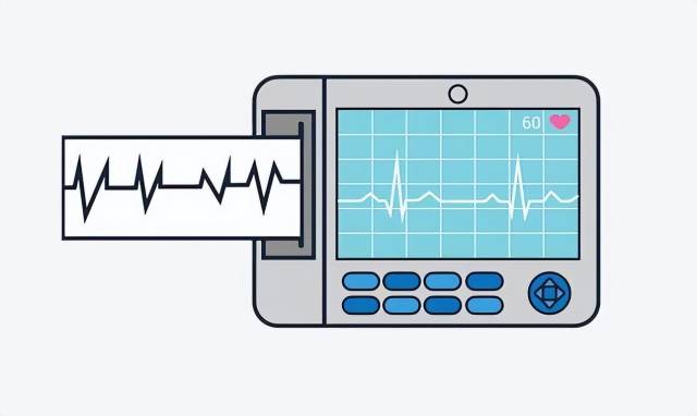 动态心电图自己怎么记录一文读懂！为什么要做动态心电图？_https://www.jmylbn.com_新闻资讯_第6张