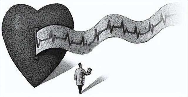 动态心电图自己怎么记录一文读懂！为什么要做动态心电图？_https://www.jmylbn.com_新闻资讯_第4张