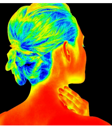 什么是光电治疗光子嫩肤、4D激光……变美项目很哇塞，不懂这个就白搭~_https://www.jmylbn.com_新闻资讯_第7张