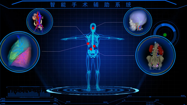 广州医疗 企业有哪些【专访】2022粤港澳大湾区高科技高成长40强 ——广州柏视医疗科技有限公司_https://www.jmylbn.com_新闻资讯_第2张