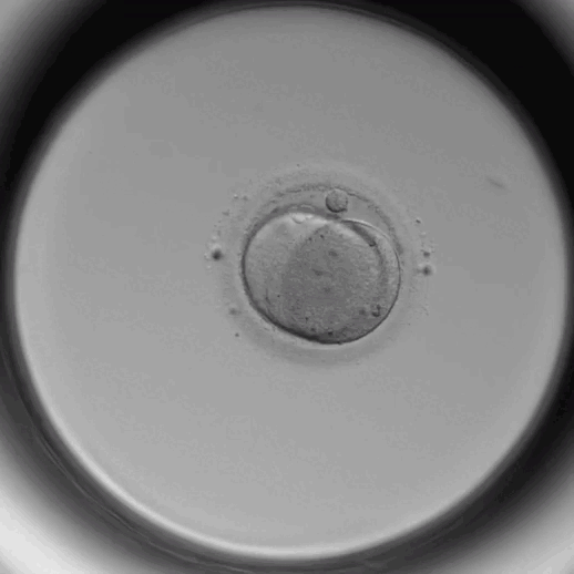 婴儿培养箱怎么用胚胎宝宝也能住“豪华套房”？时差培养箱了解一下_https://www.jmylbn.com_新闻资讯_第1张