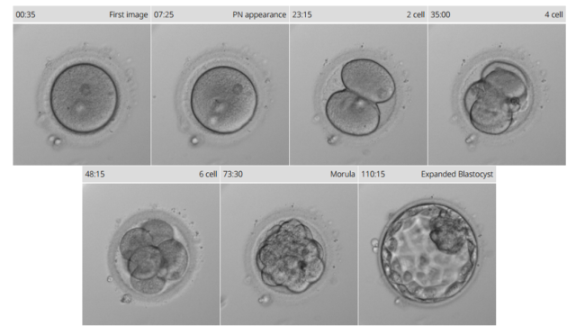 婴儿培养箱怎么用胚胎宝宝也能住“豪华套房”？时差培养箱了解一下_https://www.jmylbn.com_新闻资讯_第4张