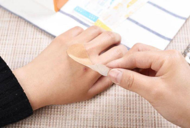 医用绷带为什么能止血液体创口贴、凡士林纱布.....常备外用小药箱还能有啥新玩意儿？_https://www.jmylbn.com_新闻资讯_第2张