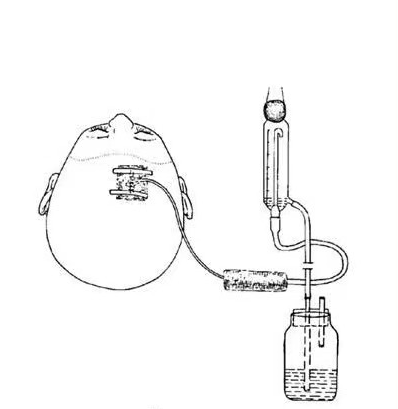 留置引流导管是什么ICU科普：带您认识ICU患者常见管道_https://www.jmylbn.com_新闻资讯_第6张