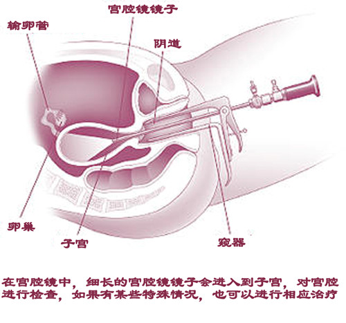 手术放大镜怎么选年轻女子久备不孕！这面“放大镜”照出真相_https://www.jmylbn.com_新闻资讯_第1张