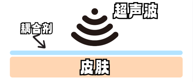 b超检查为什么涂耦合剂科普 ｜ 做B超时涂的凉凉的凝胶，原来叫做“耦合剂”_https://www.jmylbn.com_新闻资讯_第1张