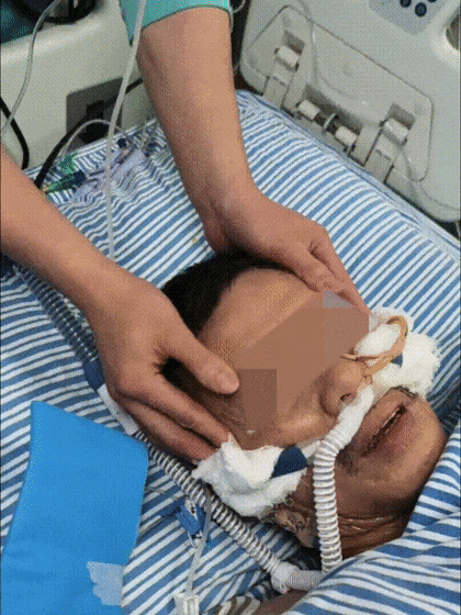 NICU苏懿行中医推拿手法