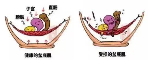 产后怎么康复治疗【特色门诊】关爱自己，从产后康复开始_https://www.jmylbn.com_新闻资讯_第2张