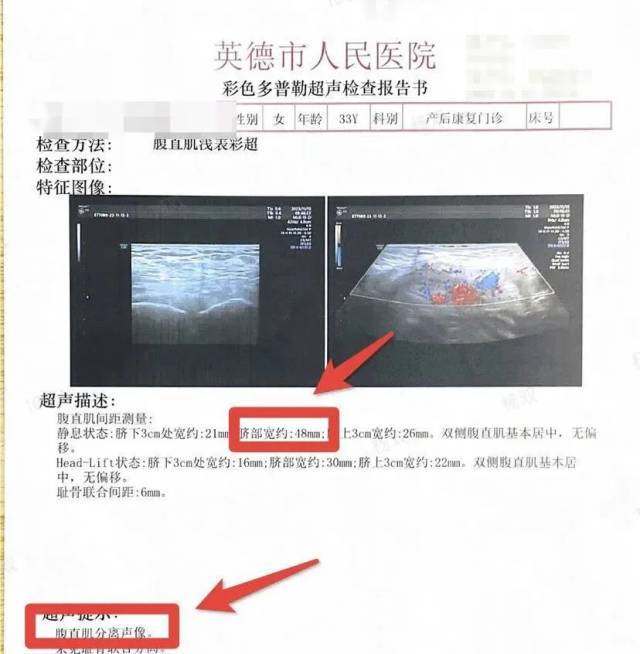 产后怎么康复治疗【特色门诊】关爱自己，从产后康复开始_https://www.jmylbn.com_新闻资讯_第6张