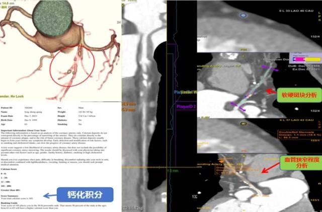 什么仪器可以全身检查超全攻略丨 CTA检查让血管疾病无处遁形！一文让你了解全身各部位的CTA影像！_https://www.jmylbn.com_新闻资讯_第14张