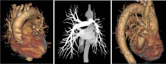 什么仪器可以全身检查超全攻略丨 CTA检查让血管疾病无处遁形！一文让你了解全身各部位的CTA影像！_https://www.jmylbn.com_新闻资讯_第8张