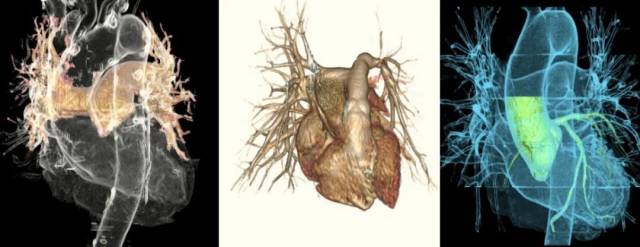 什么仪器可以全身检查超全攻略丨 CTA检查让血管疾病无处遁形！一文让你了解全身各部位的CTA影像！_https://www.jmylbn.com_新闻资讯_第9张