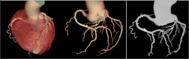 什么仪器可以全身检查超全攻略丨 CTA检查让血管疾病无处遁形！一文让你了解全身各部位的CTA影像！_https://www.jmylbn.com_新闻资讯_第5张