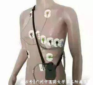 动态心电图自己怎么记录动态心电图监测－－记录您的“心路历程”_https://www.jmylbn.com_新闻资讯_第5张