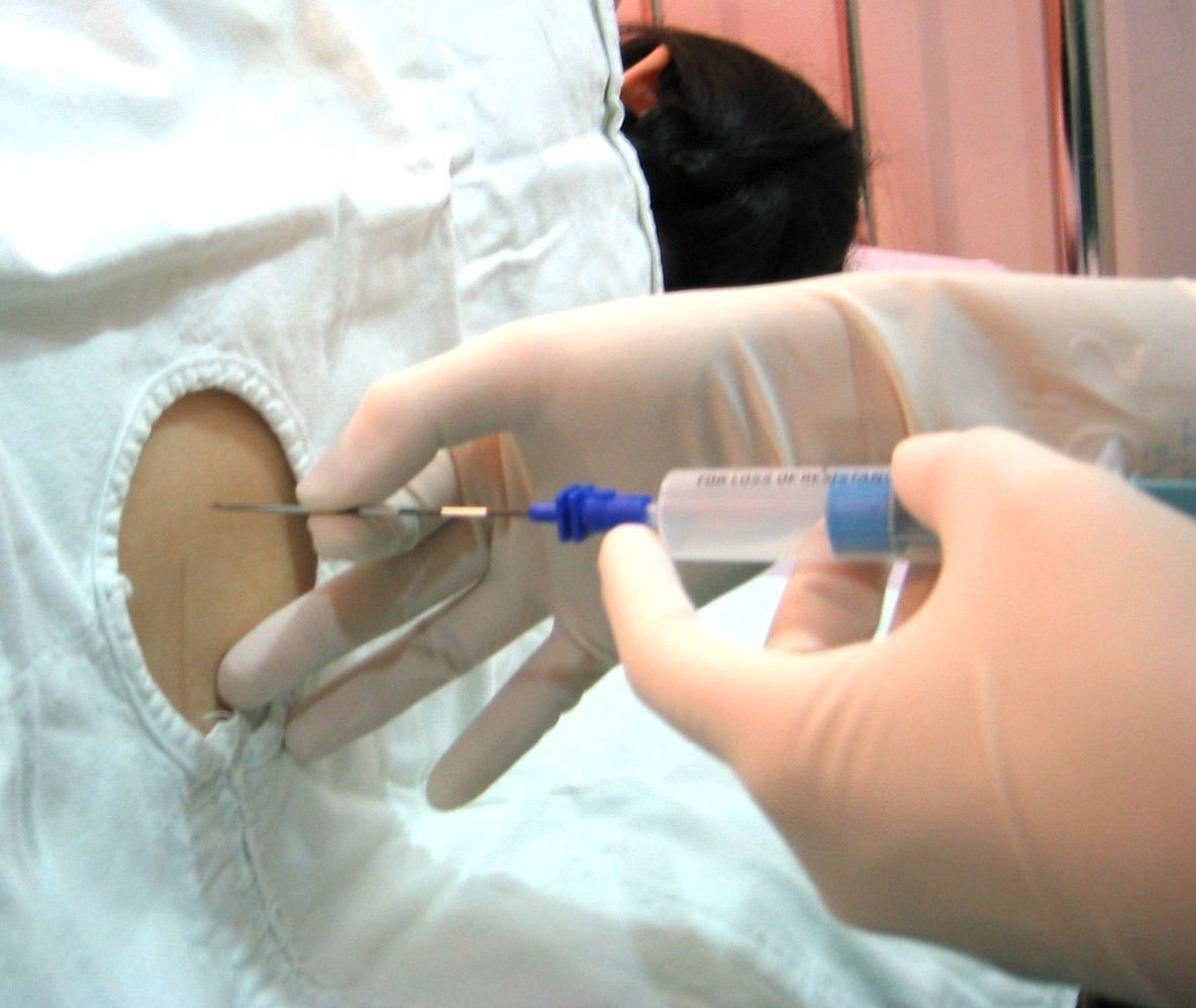 广州人生孩子不但可以不疼,还能享医保!