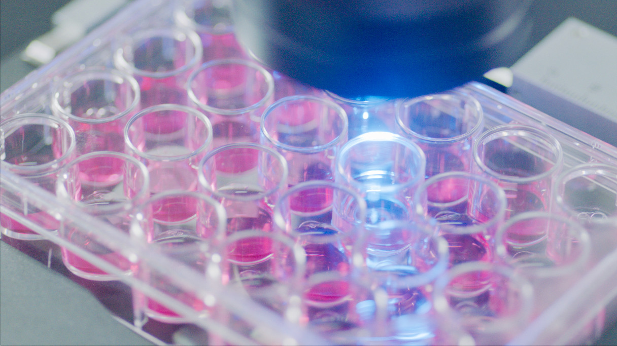 在显微镜下观察细胞状态（通讯员供图）