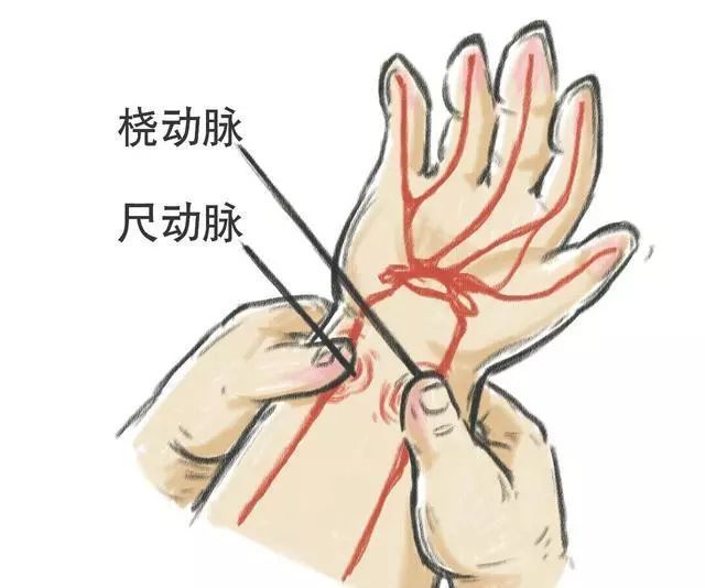 手腕动脉位置图图片
