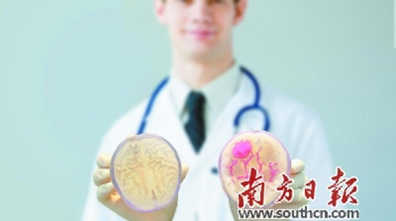 迈普医学研发的3D打印肿瘤模型，可以让医生提前进行手术规划及“彩排”，降低手术风险。受访单位供图