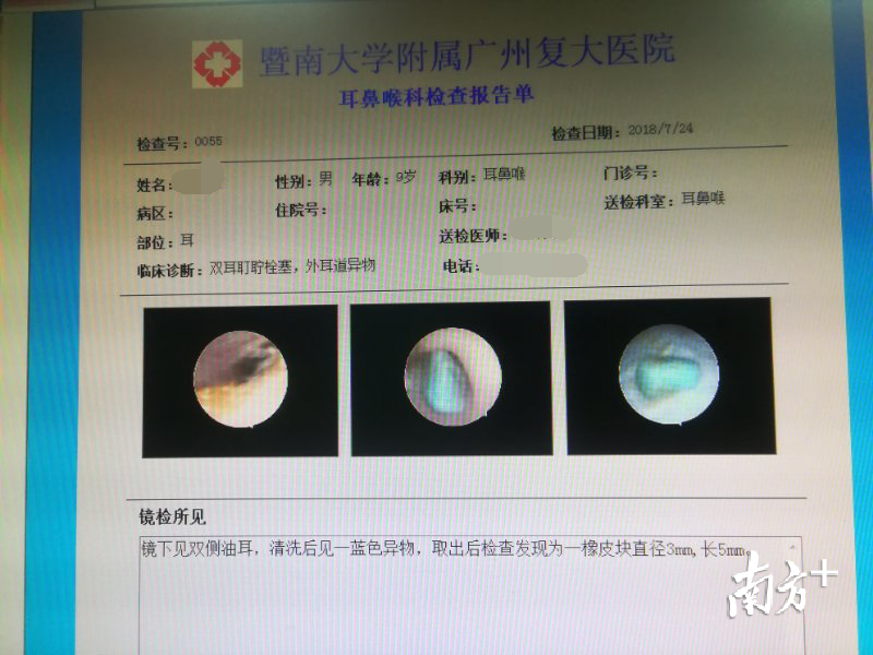 在小夏耳朵中发现了小橡皮