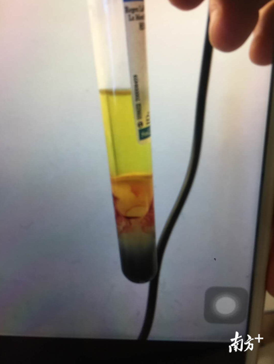 上层淡黄色液层为富含血小板的血浆