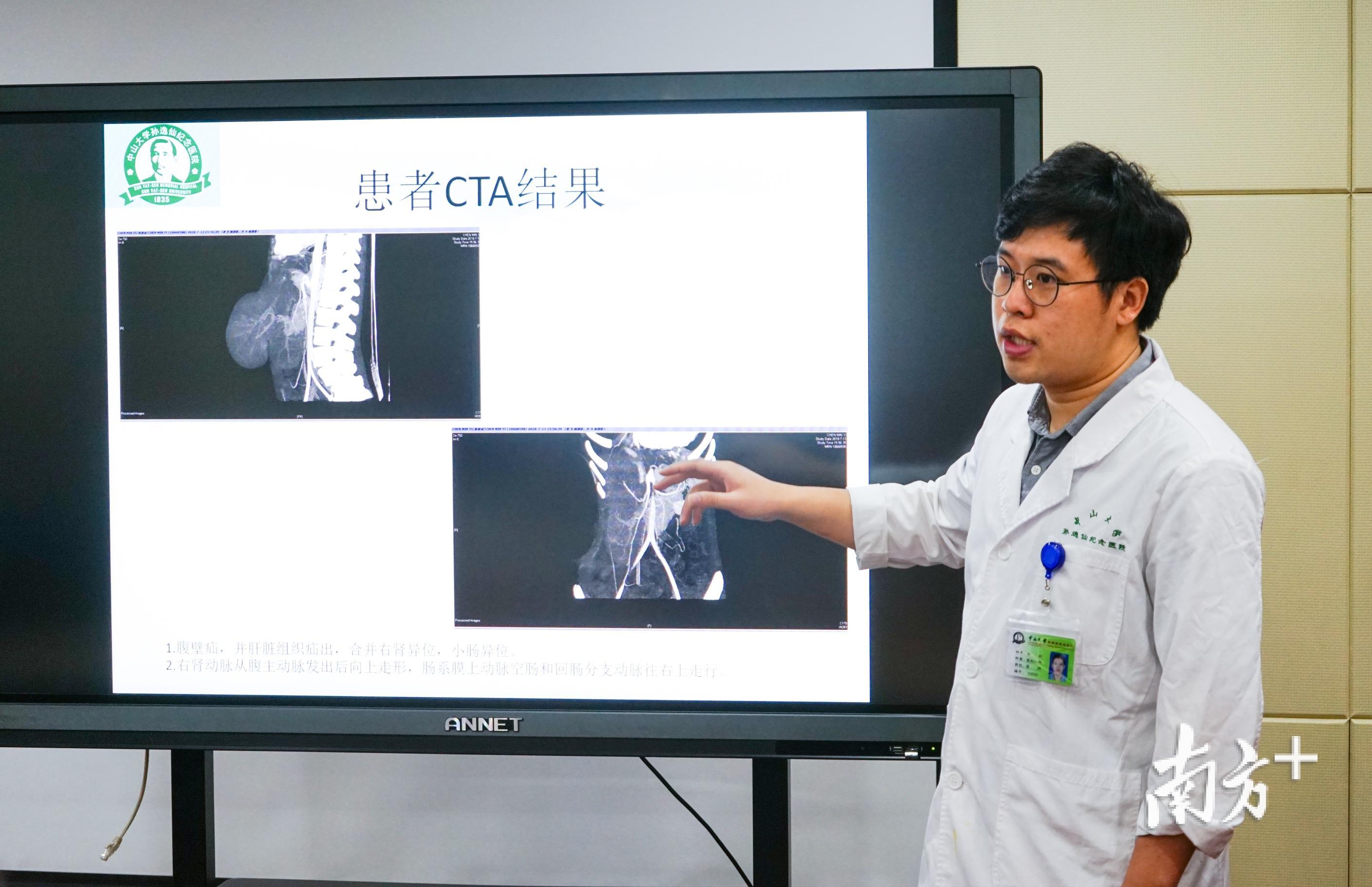 医生介绍小怡病情 医生介绍小怡病情