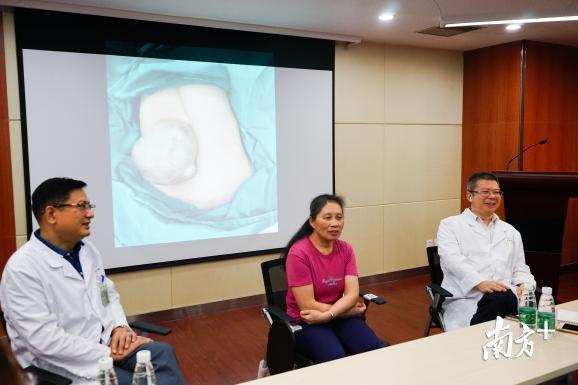 左起分别为刘超教授、小怡的养母和张金明教授 左起分别为刘超教授、小怡的养母和张金明教授