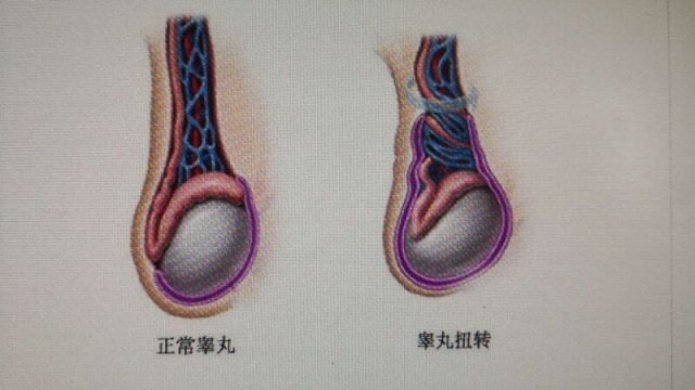 "蛋疼"千万不要忍!16岁少年忍了7天不就医,最后