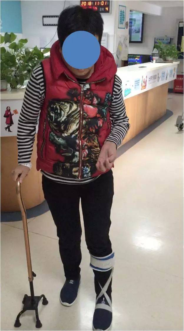 给偏瘫手换个大脑!