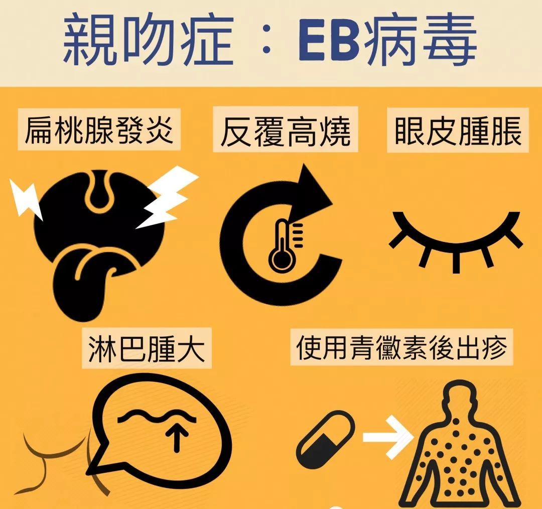 医学上从来都不存在eb病毒流感,流感病毒只包括甲型,乙型,丙型和丁型