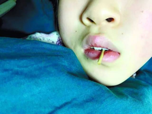 穿热狗的竹签笔直戳进口腔.