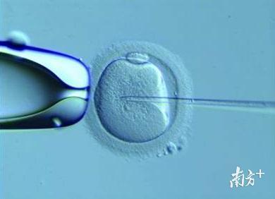 单精子注射影像。