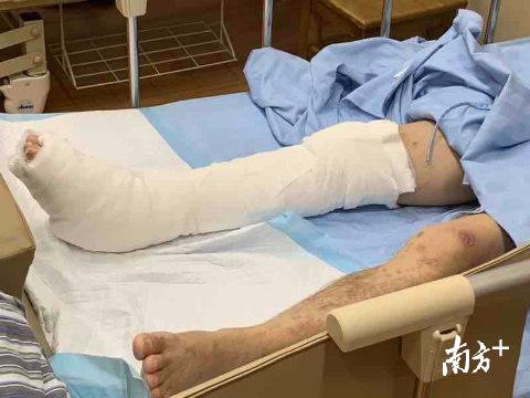 糖尿病患者 糖尿病患者