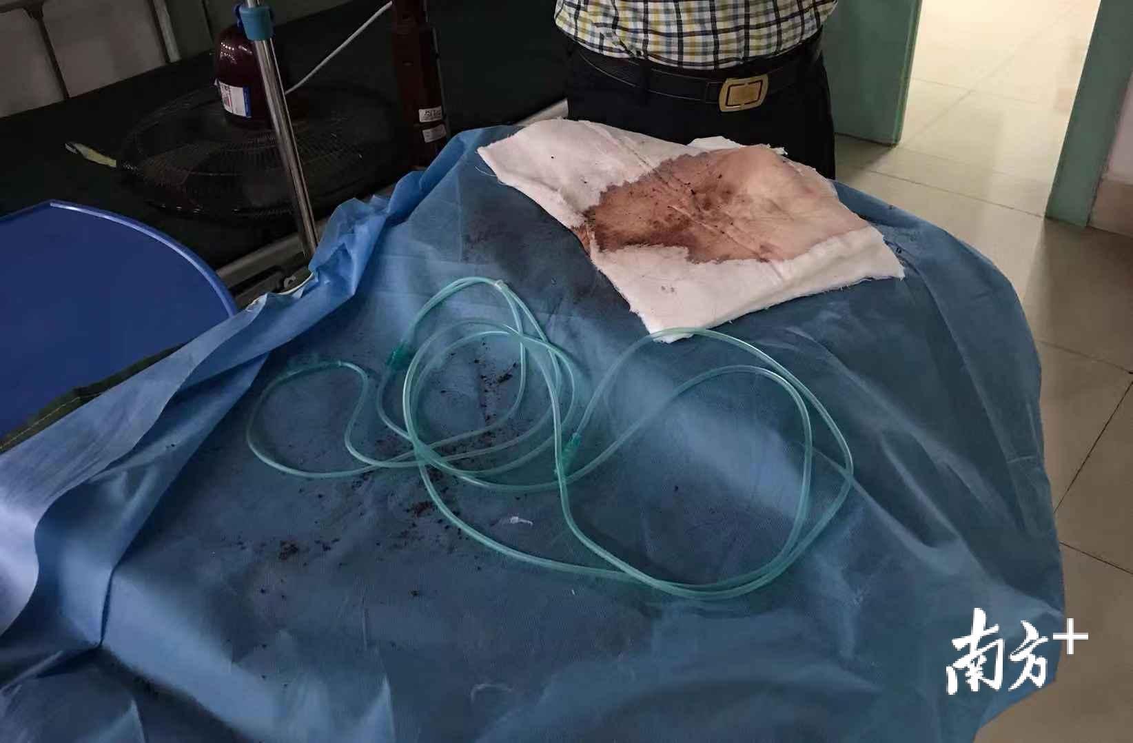 8月1日早上，在贺州市中医院骨科住院部，一架运送过伤者的病床被放在走廊过道上。
