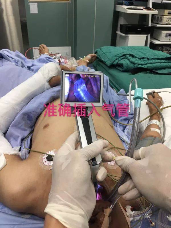 可视喉申请怎么可视喉镜，让气管内插管一目了然_https://www.jmylbn.com_新闻资讯_第2张