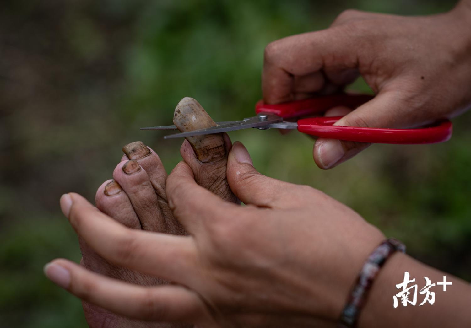 管延萍为学罗军剪掉又黑又长的脚趾甲。