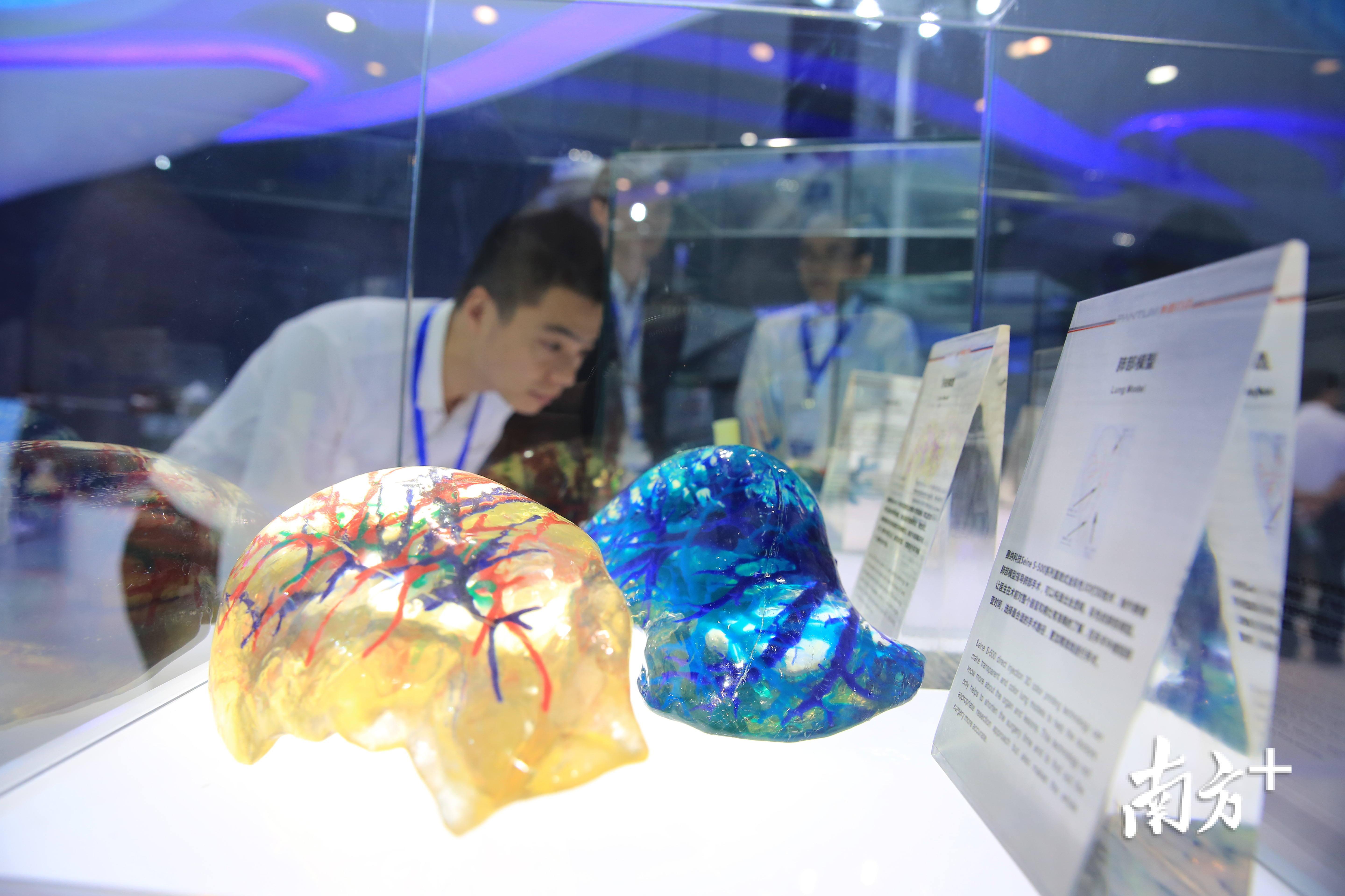 珠海赛纳科技的3D打印肺部模型。王荣 摄 珠海赛纳科技的3D打印肺部模型。王荣 摄
