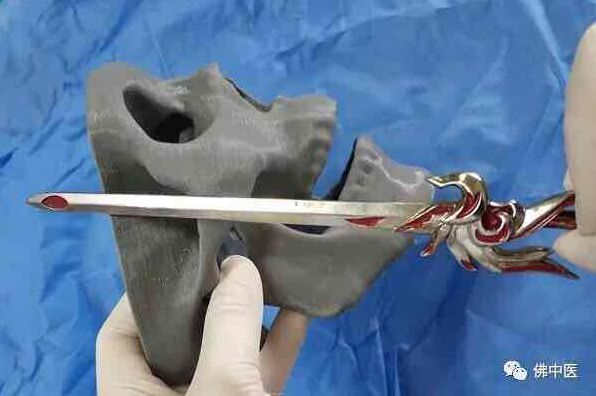 插入深度演示图。