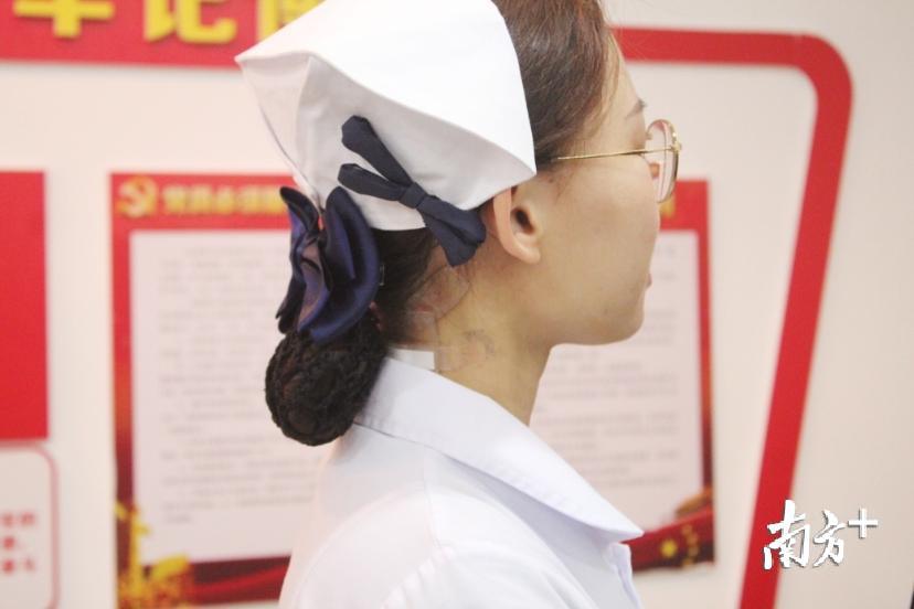 陈晓佳现在颈后还贴着护贴