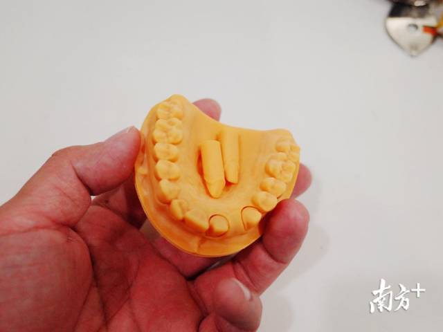 3D打印的牙模。
