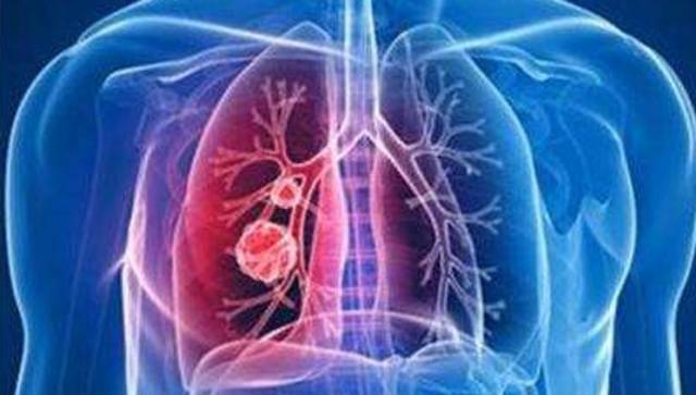 口罩怎么选、怎么戴才对？佛山疾控医师告诉你N个误区