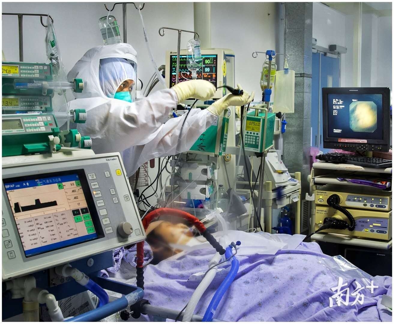 2月12日医护人员正使用纤维支气管镜为彭晓吸痰.