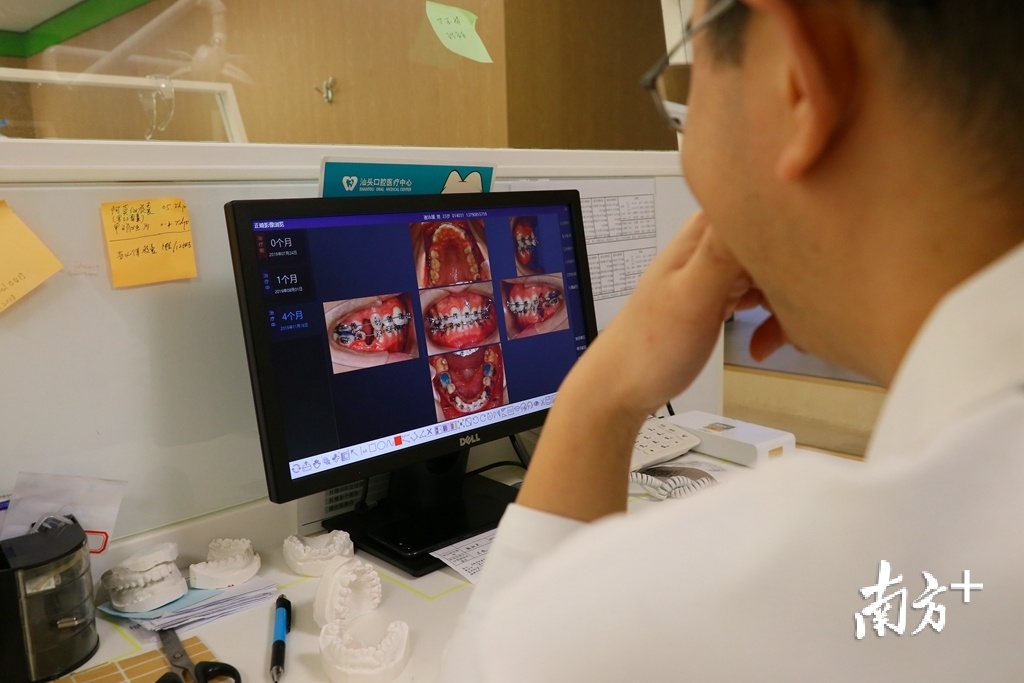 医生正在查看患者正畸前后效果。 医生正在查看患者正畸前后效果。