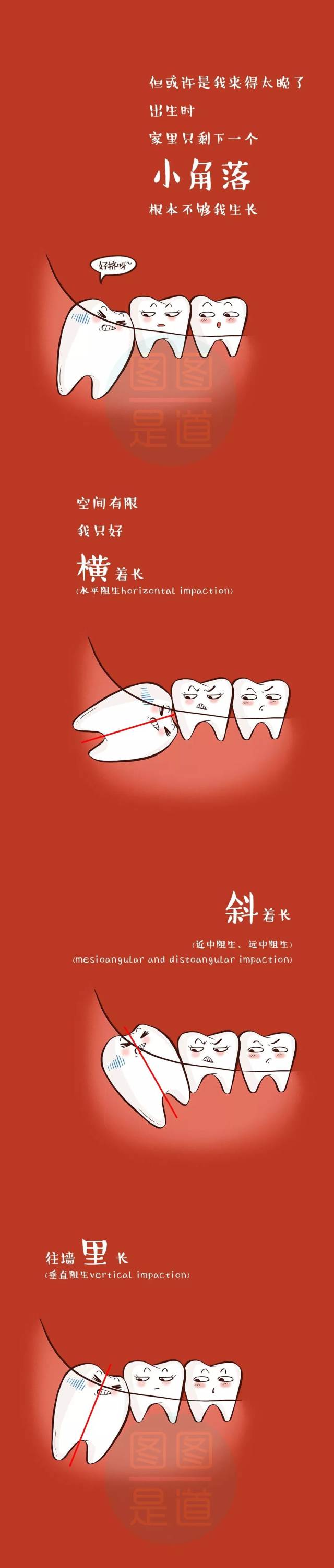 智齿|这儿有一颗智齿要发言(炎)