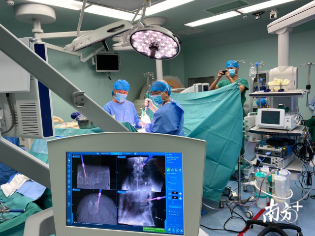 手术|腰突压迫左腿麻痛小便困难 三维导航下椎间孔腰椎减压固定融合术后缓解