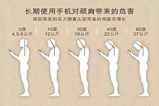 颈椎|脖子又酸又僵？试试看这个，拯救“低头族”