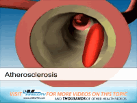 高血压|看似“无大碍”的高血压是如何一步步地损坏身体的?